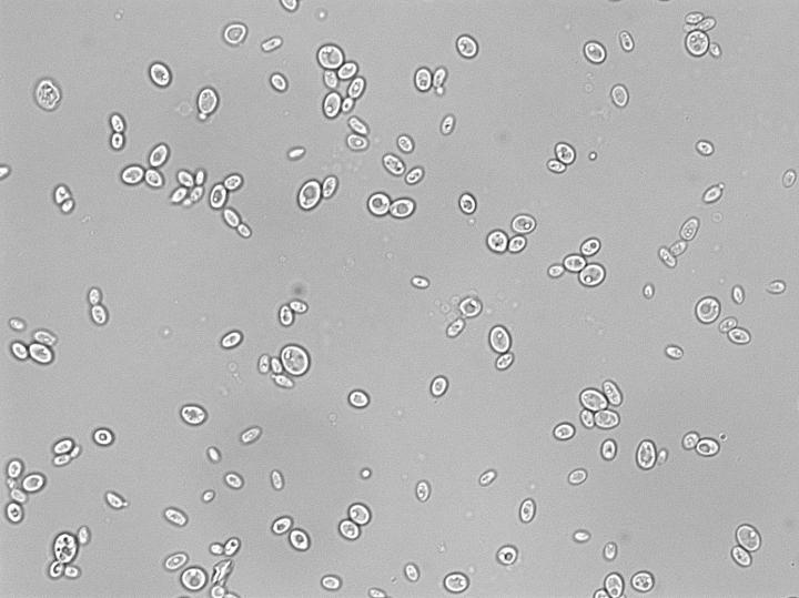 <i>Candida glabrata</i>