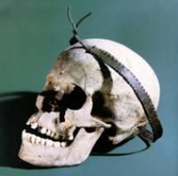 Copper Age Skull from Hungary