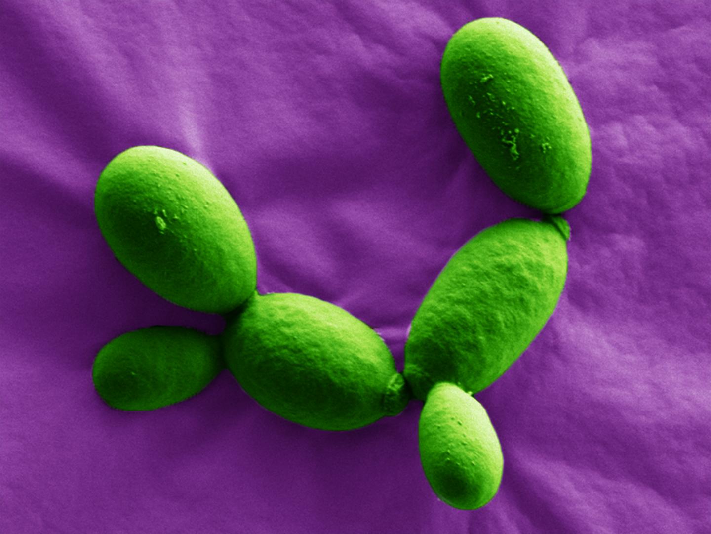 New yeast species marks milestone for collect EurekAlert!