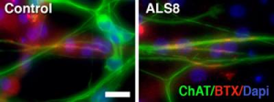 ALS8 Motor Neurons