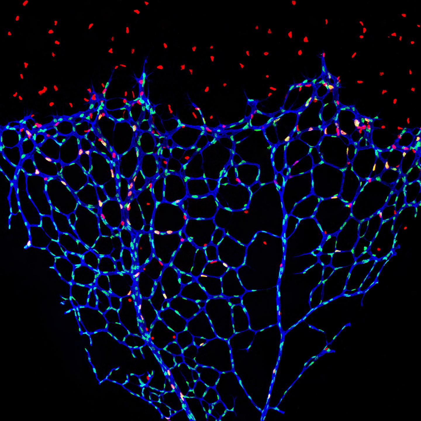 Restricted Blood Vessel Growth Due to S-2-Hydroxyglutarate