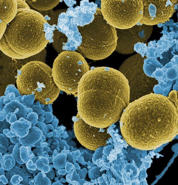 Different Strains of Same Bacteria Trigger Widely Varying Immune Responses