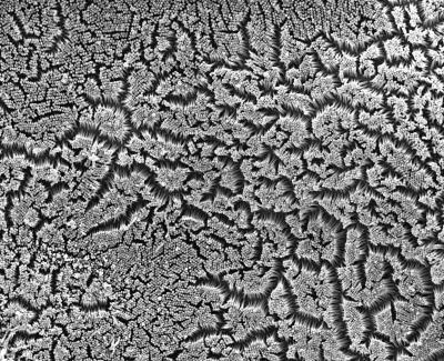 Scanning Electron Micrograph of Brush Border