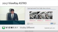 Percy Lee, M.D., ASTRO 2017 Presentation on MRIdian for pancreatic cancer