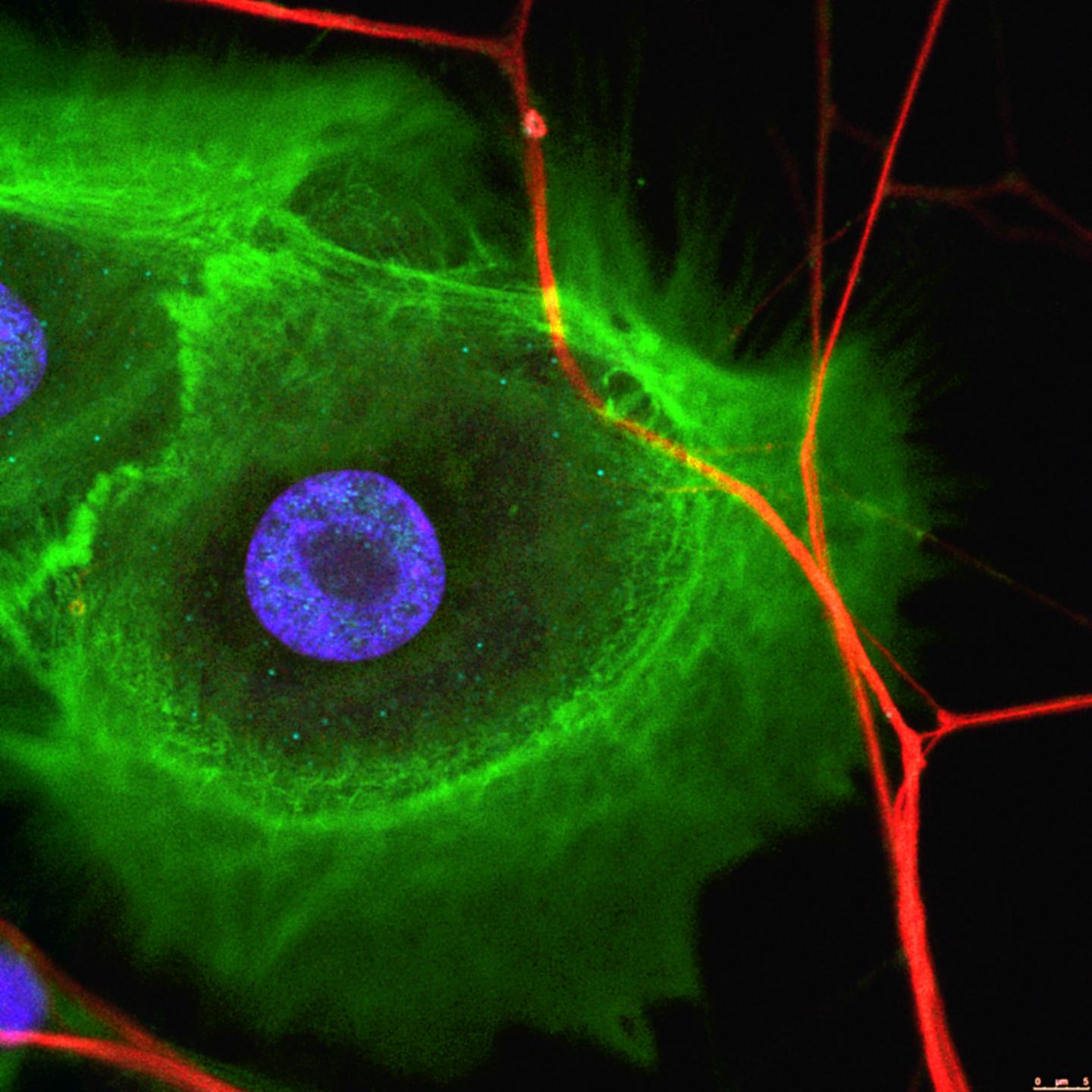 Tumor Innervation