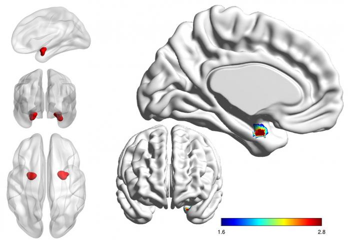 Amygdala