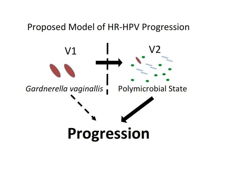 Microbiome May Hold Key to Identifying Hpv-Infected Women at Risk for Pre-cancer