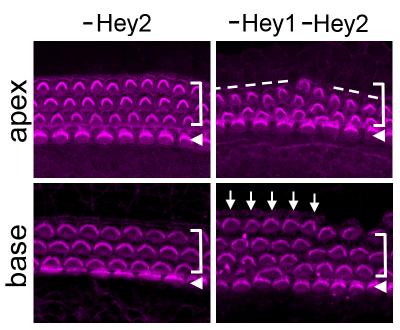 Lack of Hey1 and Hey2 Causes Disorganized Cochlear Hair Cells