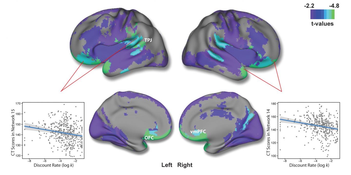 Cortical Thickness