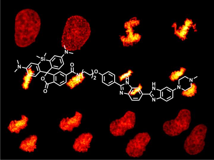 HeLa Cell Stained with SiR-Hoechst