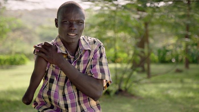 Snakebite Victim Sundai, from Kenya's Baringo County