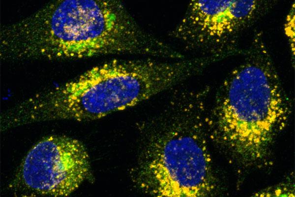 Discovery May Lead to More Efficient Gene Therapy Treatments