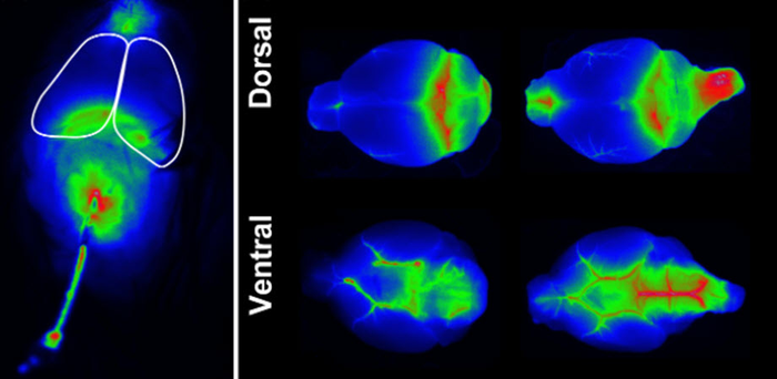 Infrared cerebrospinal fluid tracer dynamically imaged with the LICOR Pearl IR imaging system allows assessment of tracer movement over the surface of the cerebral convexity as a surrogate measure of glymphatic exchange.