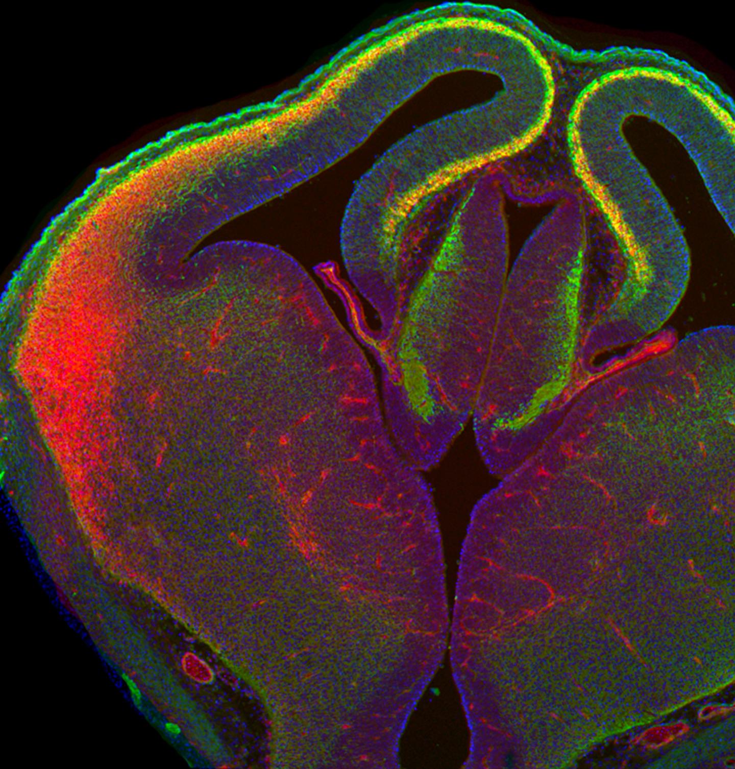 Scientists at the Salk Institute Discovered New Details into How Master Proteins Dictate Neuron's Sp