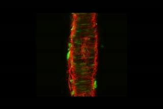 MU Researchers Find Unique Protein Organization in Arteries Associated with Cardiovascular Disease
