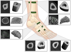 Shin and foot bones