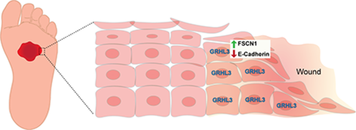 GRHL3/FSCN1/E-cadherin pathway