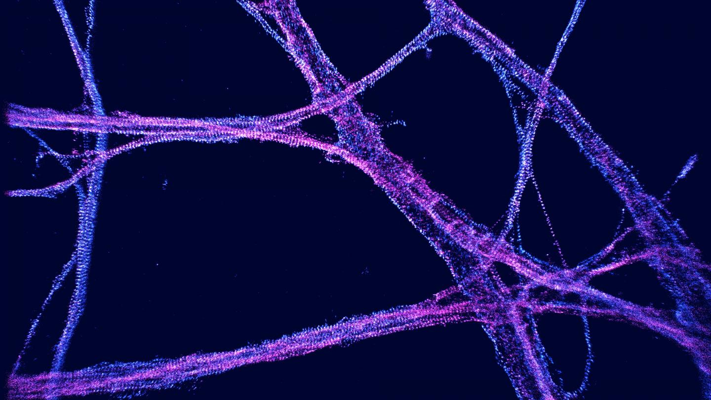 Viewing Neurons in vLume