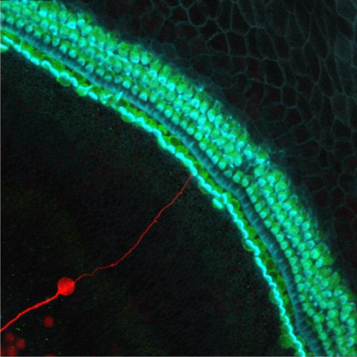 Stem Cell-Derived Neuron