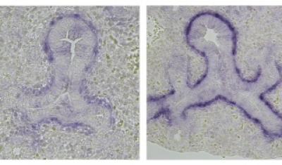 Prenatal Vitamin A Deficiency Tied to Postnatal Asthma