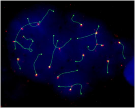 Desvelan cÃ³mo alteraciones en la organizaciÃ³n 3D del genoma afectan a la fertilidad