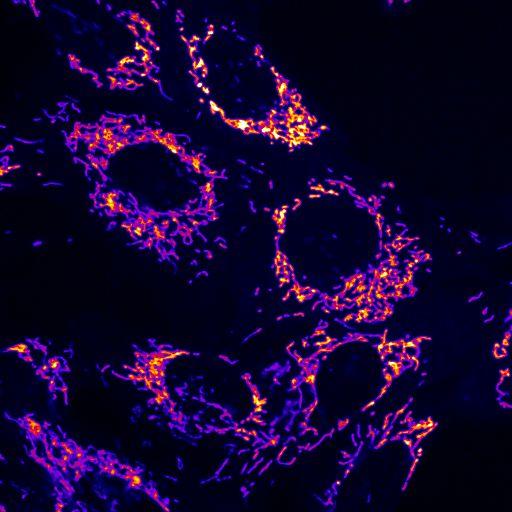 Fluorescence microscopy image of tinted mitochondria