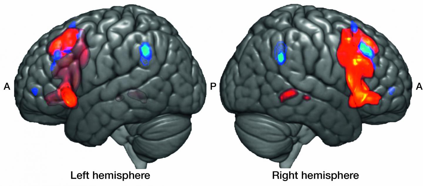 The Equivalent of Broca's Area Plays a Similar Role but for Processing Music instead of Language