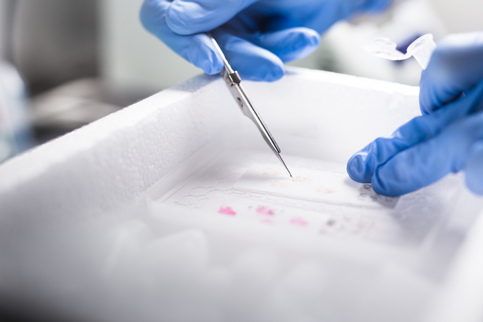 Preparing the tumor tissue for sequencing
