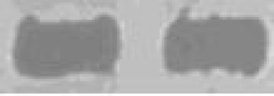 Immunoglobulin G Without Polarization