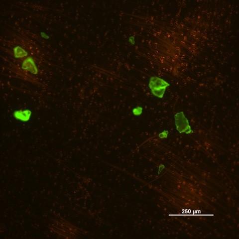 Smaller Ocean Microplastics (2 of 2)