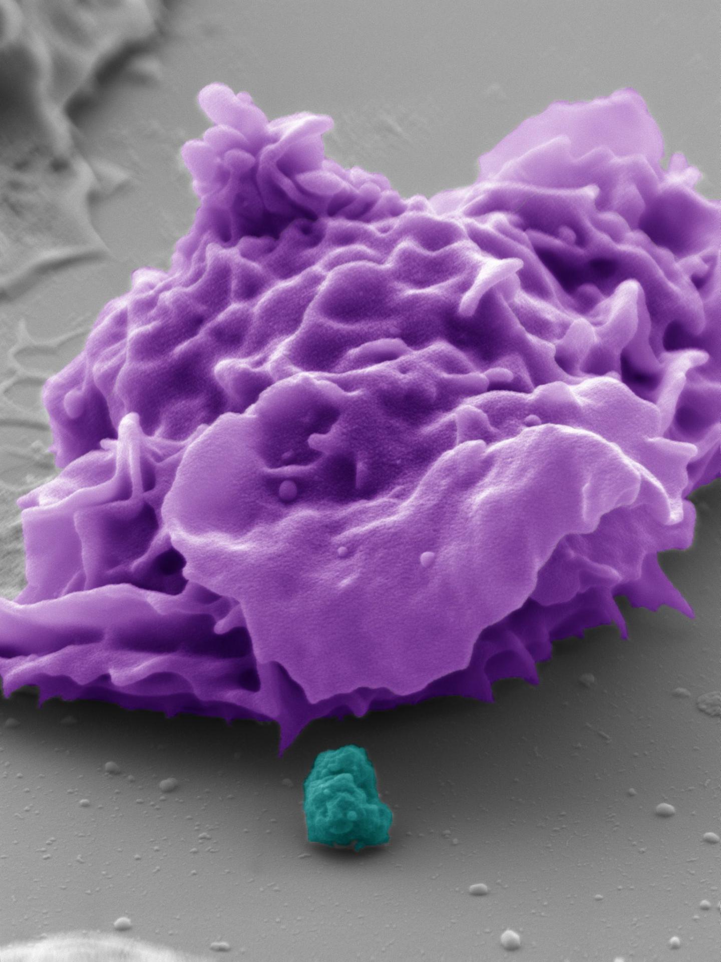The Pseudocolored Electron Microscope Image