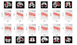 Figure 4. Source-Based Morphometry sources relationship to age.