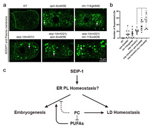 PC deficiency suppresses seipin: New insights into Berardinelli-Seip congenital lipodystrophy type 2