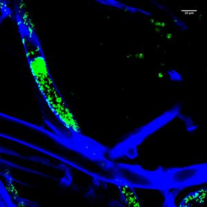 Bacteria entrapped in fungal hyphae