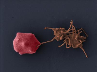 Platelets Attack Malaria Parasites with PF4 (1 of 5)