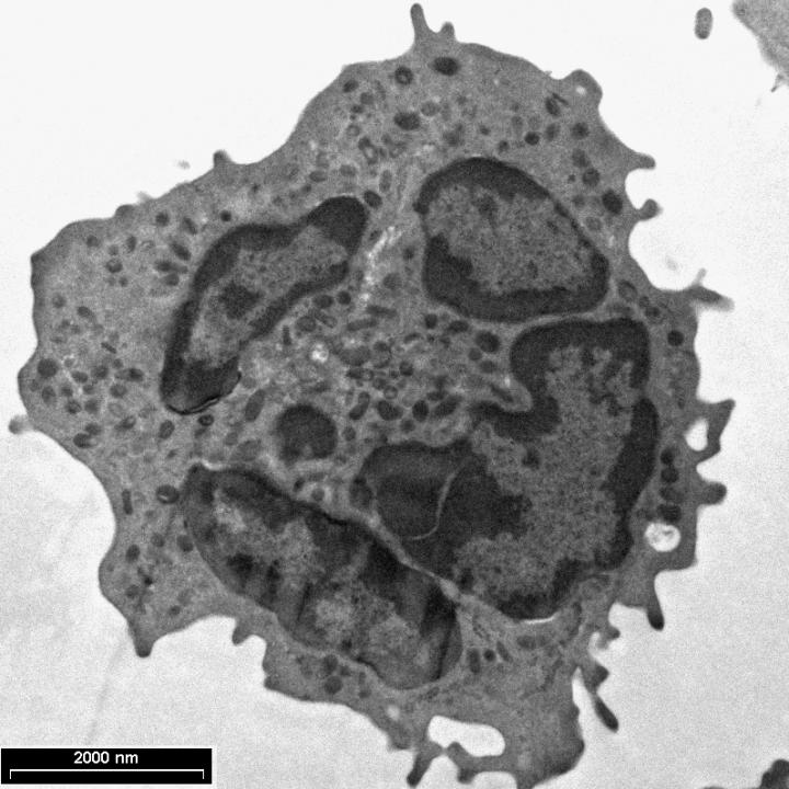 Electron Microscope Image of a Harmful Neutrophil