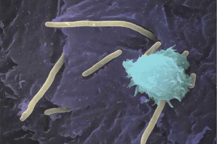 Aggressive UTI Bacteria Hijack Copper, Feed Off It