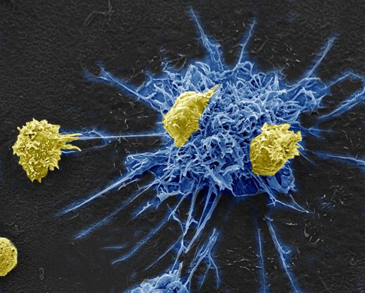 HIV Immunotherapy