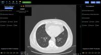 Lung CT without COVID-19