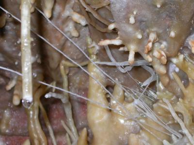 Some Growing Cave Formations Appear to Defy Gravity