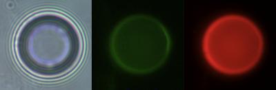 Microbubbles to Light the Way to Sentinel Lymph Nodes of Breast Cancer Patients