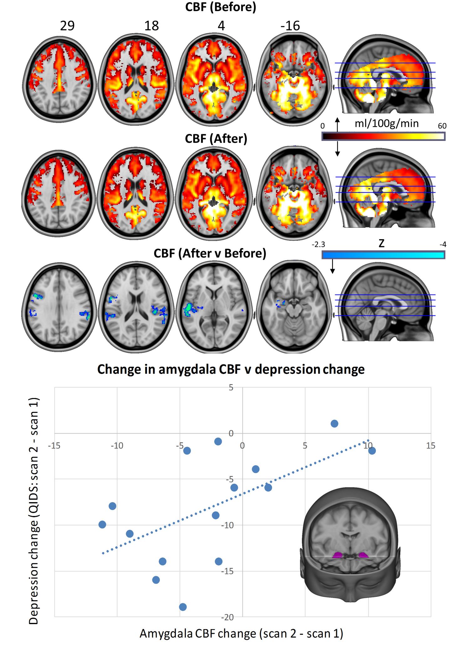 magic mushrooms effects on brain