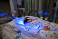 Infant Undergoing Phototherapy (horizontal)