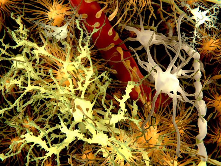 Amyloid Plaques and Neurons in the Brain
