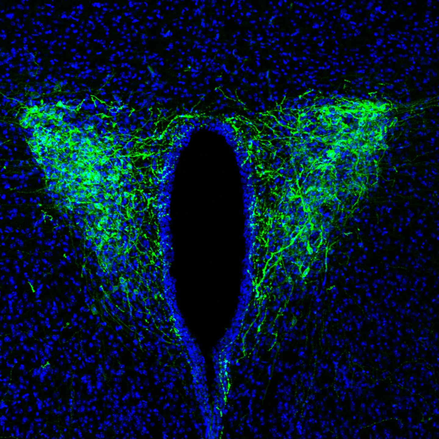 CRF neurons