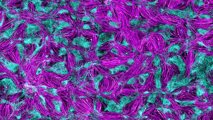 2D neuromuscular junction model