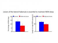 Lesion of the Lateral Habenula Reduces REM Sleep Length