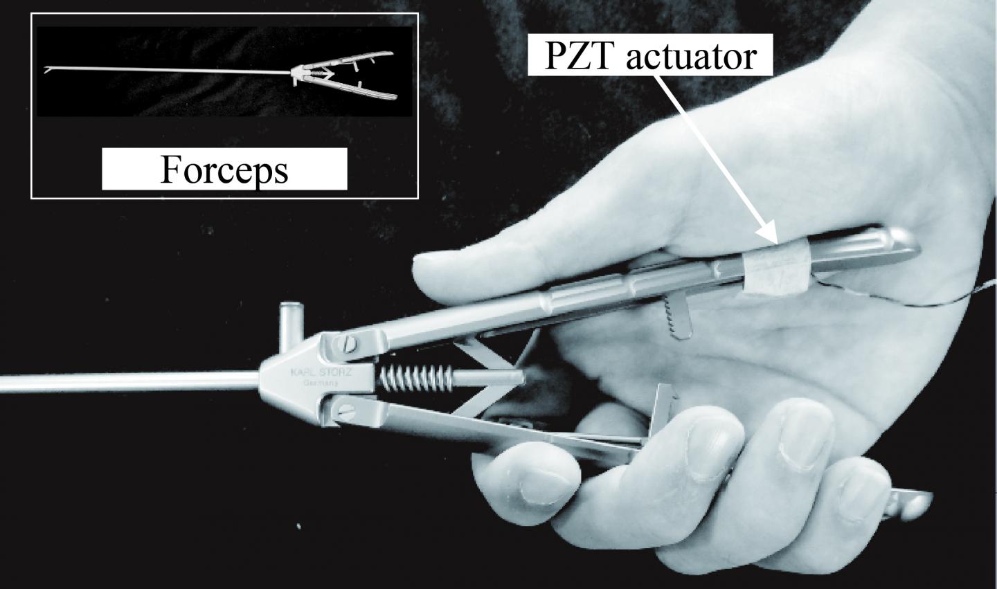 View of the PZT Actuator Attached to Standard Surgical Forceps During Laparoscopic Surgery