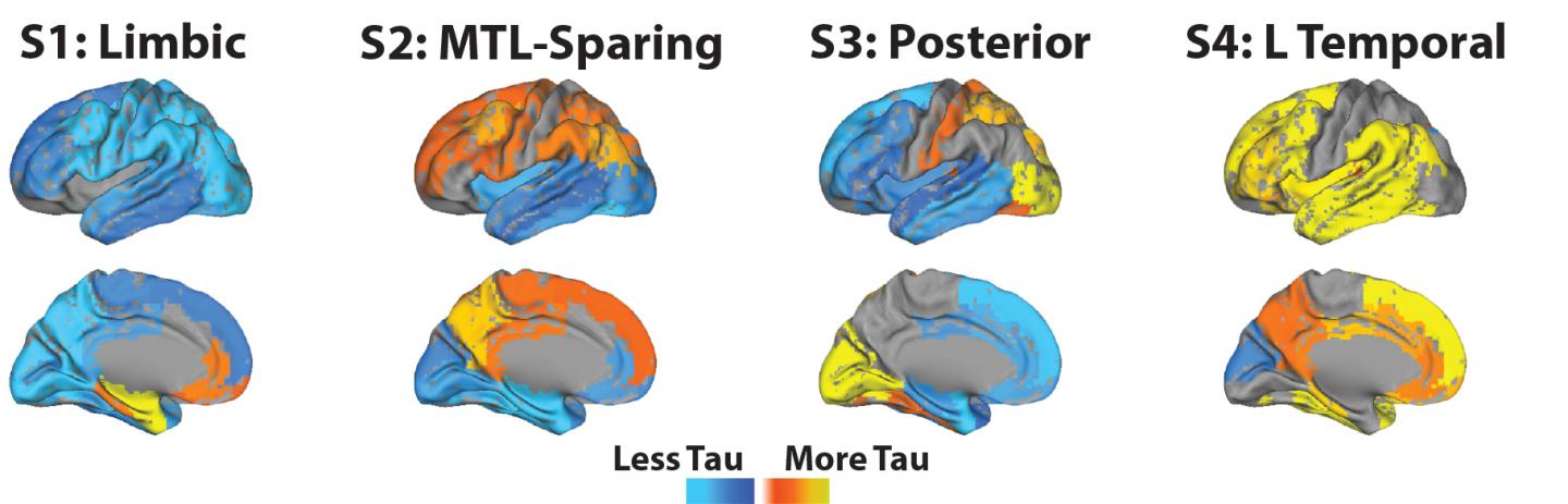 The four subtypes