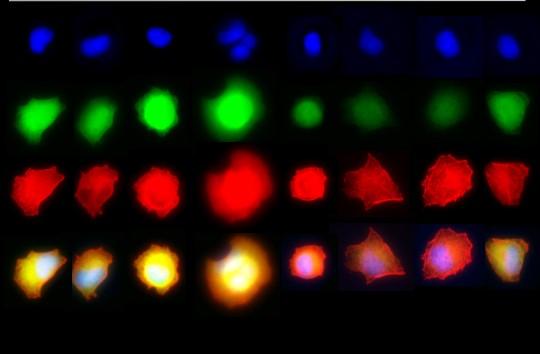 Single Cell Analysis